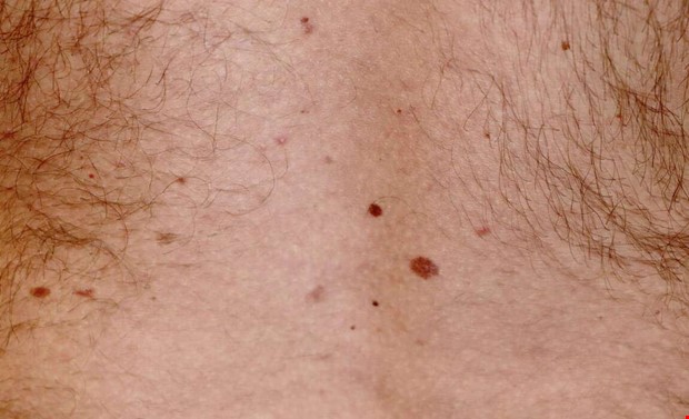 Flckmottagning stngd efter flera brister