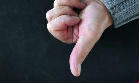 Stelopererad tumme efter v�rdmiss � ingen �tg�rd