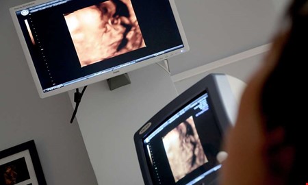 Debatt: Aborträtten är inte till salu 