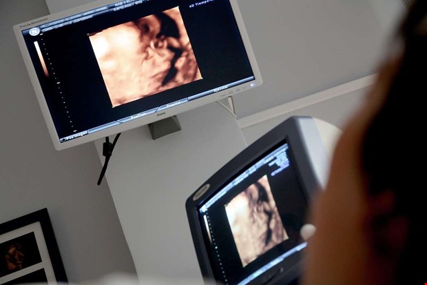 Debatt: Aborträtten är inte till salu 